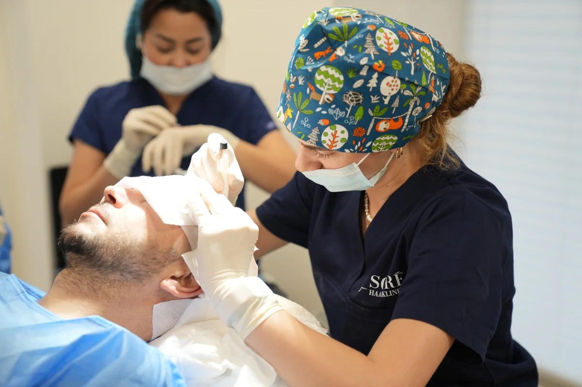 Baardtransplantatie procedure bij Soré Haarkliniek