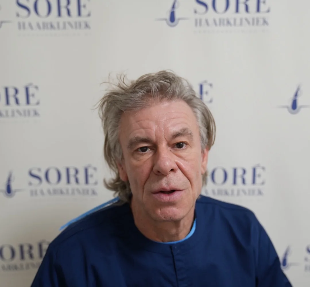 Haartransplantatie van Roy - beeld voor de behandeling